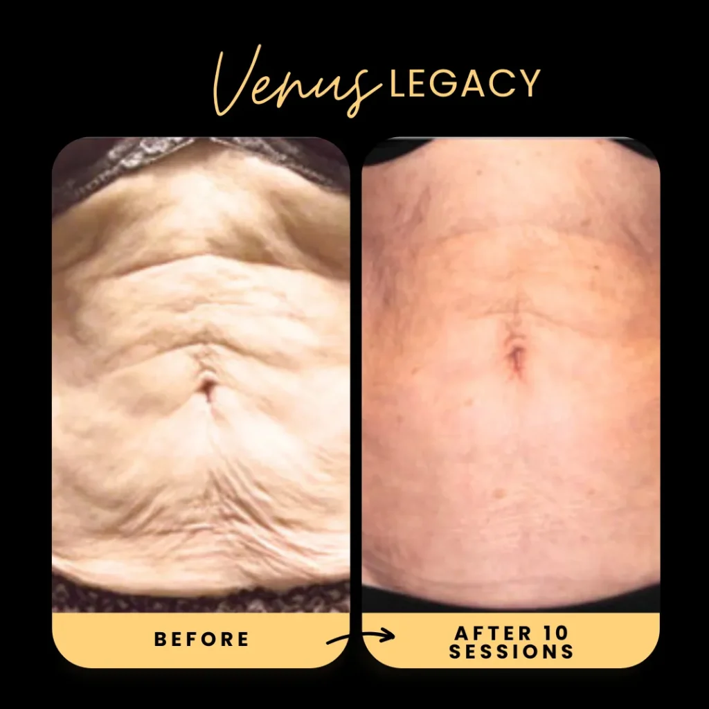 10_BodyLanguage_websize